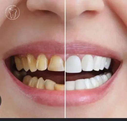 Why Choose Our Cosmetic Dentistry