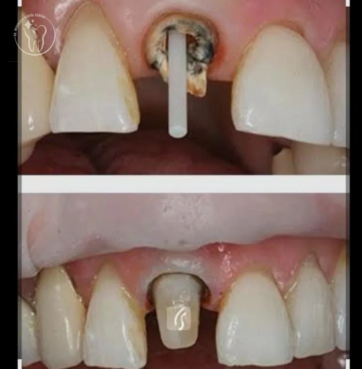 Broken Tooth, Bleeding Gums, or a Scared Kid: Your Guide to Urgent and Everyday Dental Care in Sonipat